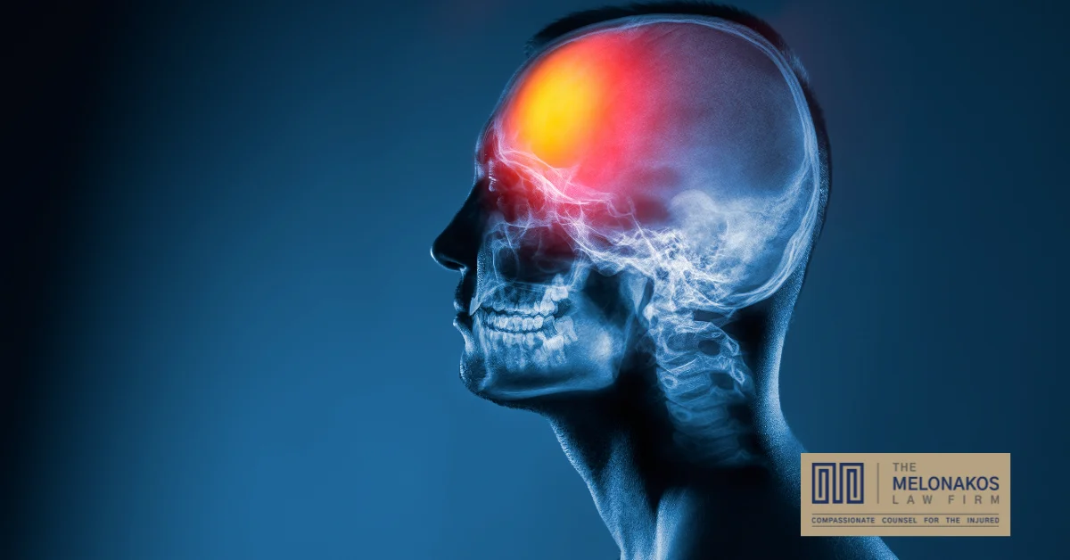 X-ray of a man's head. Medical examination of head injuries. Frontal part of the brain is highlighted in a different color
