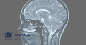 Doctor reviewing a brain scan for signs of a brain injury after a Greenville accident